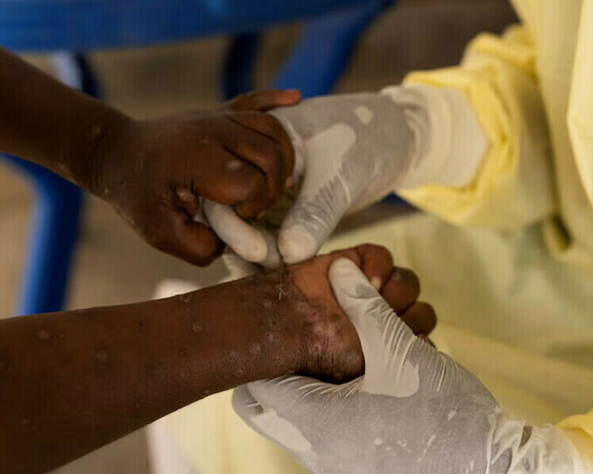 Thailand-MPOX