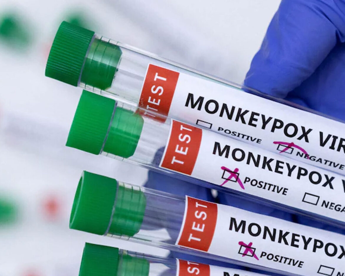 monkeypoxs