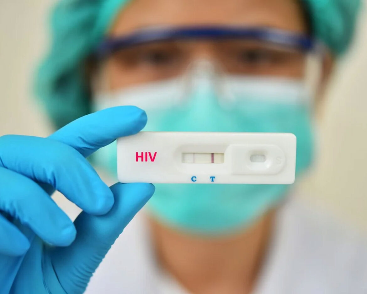 HIV-spread